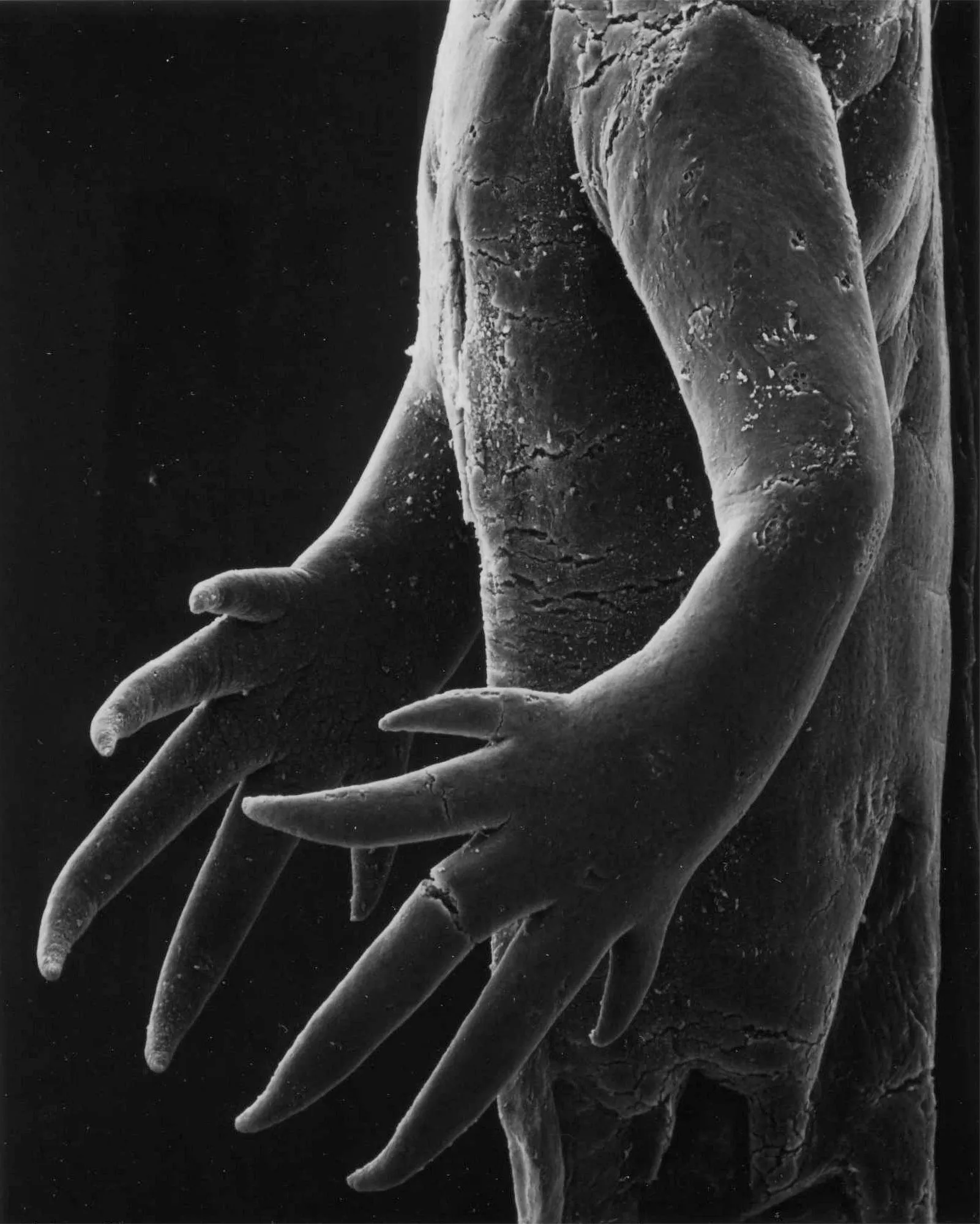 44-02-1 Hands of a Salamander Larvae, 25x